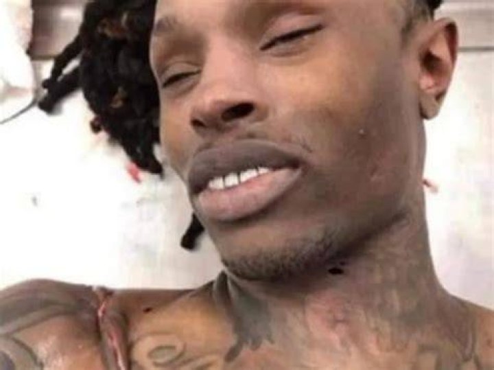 King Von Autopsy Photo: Explicit And Disturbing