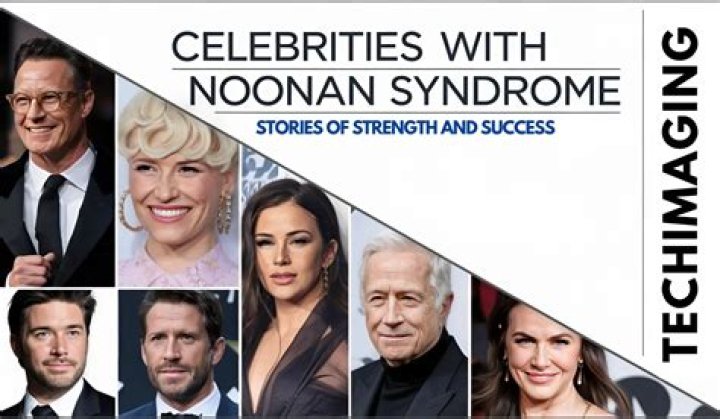 Sparkling Actresses With Noonan Syndrome: Inspiring The World