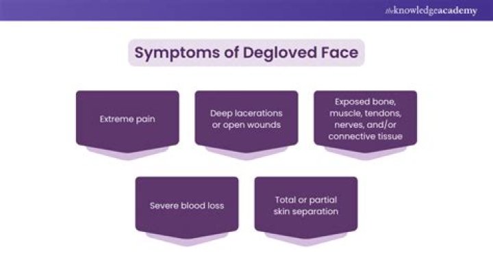 Unveiling The Horrors: Understanding The Degloved Face💀